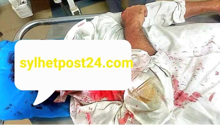 সিলেটে পুলিশী হেফাজতে যুবদল নেতার মৃত্যু, জেলা ও মহানগর বিএনপির ক্ষোভ প্রকাশ