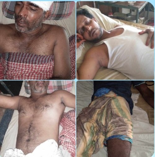 নবীগঞ্জে সন্ত্রাসী হামলায় সাংবাদিক মুজিবুর রহমান সহ আহত -৭ 