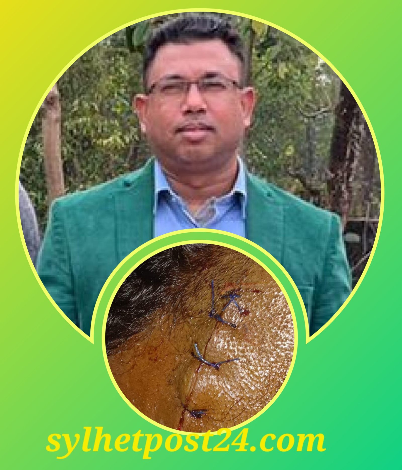 সিলেটে স্বতন্ত্র প্রার্থীর নির্বাচন পরিচালনার প্রধান সমন্বয়কারী মাহমুদুল’র উপর ছাত্রলীগ ক্যাডারদের সন্ত্রাসী হামলা