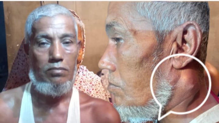 অর্থাের অভাবে চিকিৎসা করাতে পারছেন না ক্যান্সারে আক্রান্ত আজিজ