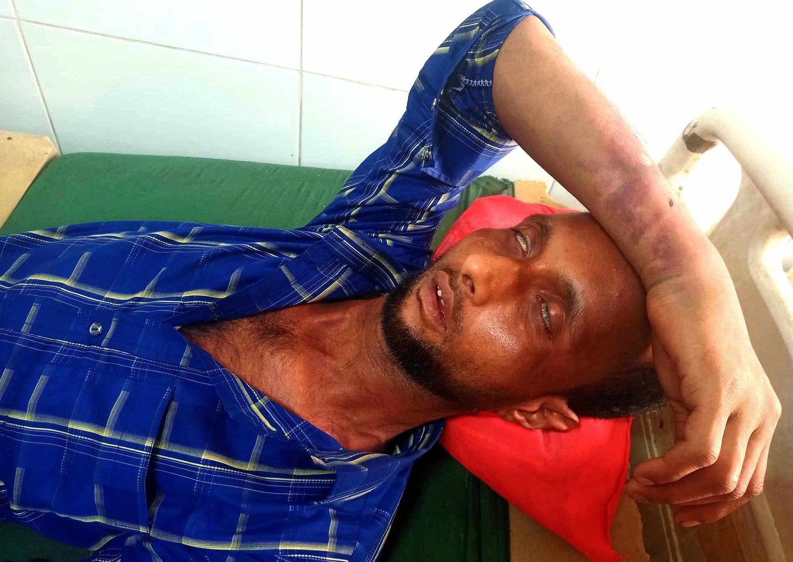 তাহিরপুরে এক ব্যবসায়ীকে পিঠিয়ে হাত ভেঙ্গে দিয়েছে চোরাকারবারীরা,থানায় অভিযোগ দায়ের
