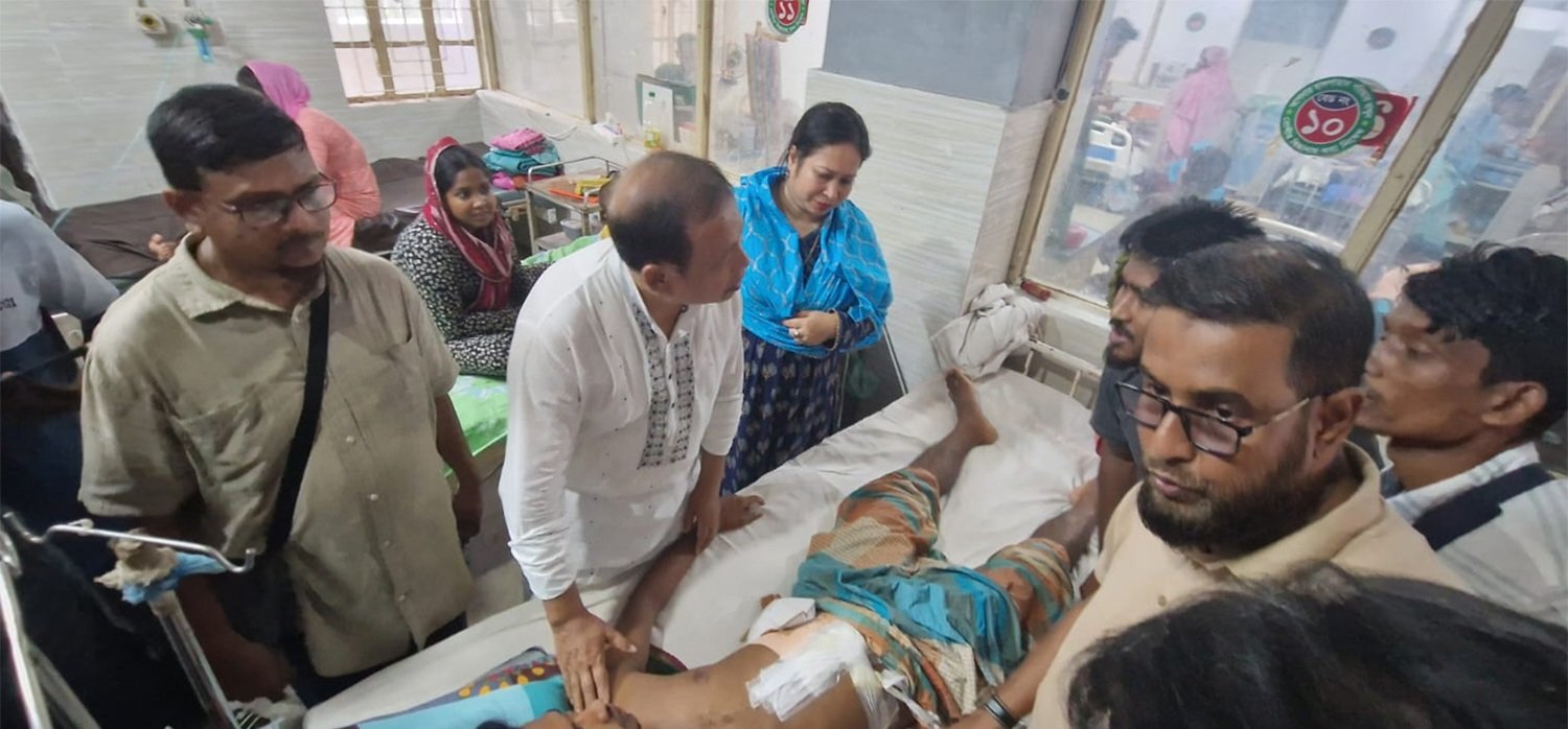ওসমানীতে আহতদের চিকিৎসার খোঁজ নিতে এমদাদ চৌধুরী