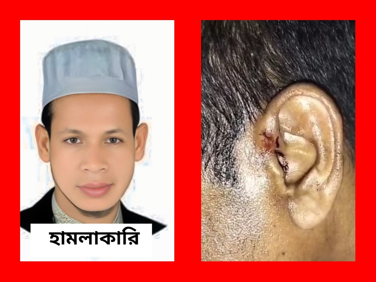 বড়লেখায় সাংবাদিকের উপর সন্ত্রাসী হামলা মোবাইল ফোন ও টাকা ছিনতাই