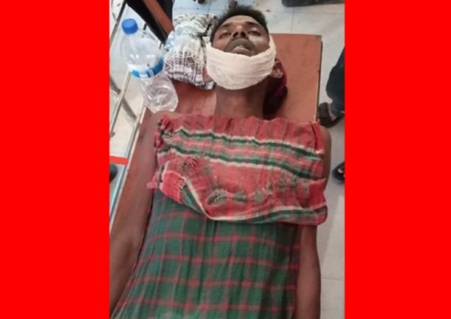 জামালগঞ্জে পূর্ববিরোধের জেরে দুই পক্ষের সংঘর্ষে নিহত ১ , আহত -১০, আটক ৪ জন