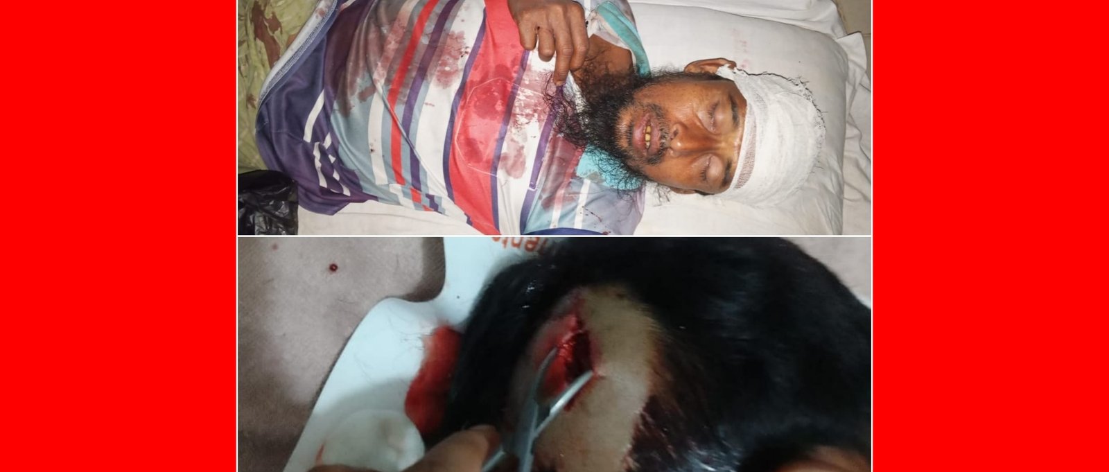 ধামইরহাটে সালিশে শাসনের জের, মামা শ্বশুরকে বাটাম দিয়ে আঘাতের অভিযোগে ভাগ্নি জামাই গ্রেফতার